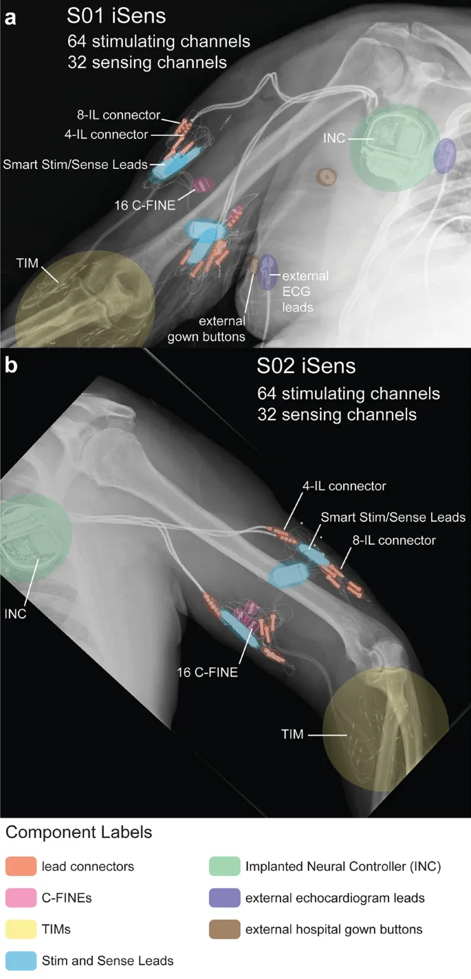 X-ray of implanted neural interface