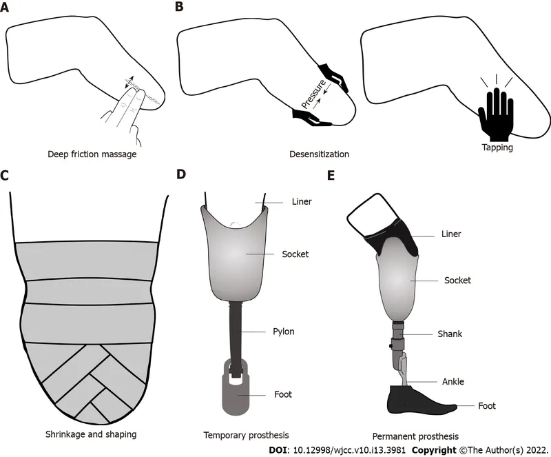 Prosthetic fitting and training techniques