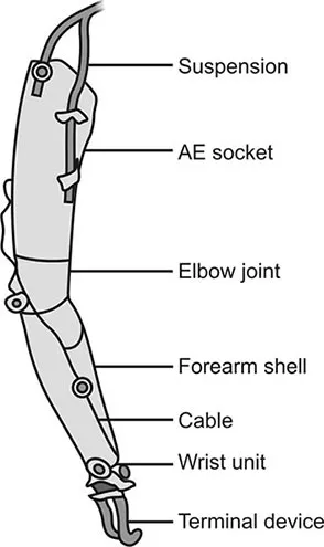 Above-elbow upper limb prosthesis components