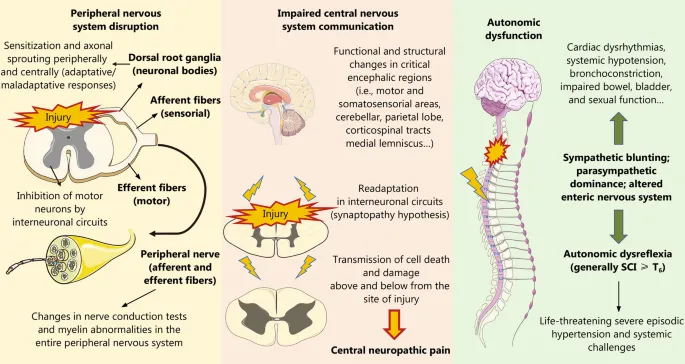 Spinal Cord Injury Pathophysiology Diagram