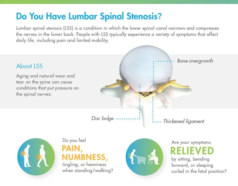 Lumbar Spinal Stenosis Symptoms and Relief