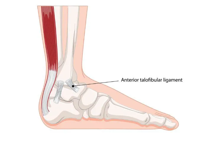Anterior talofibular ligament (ATFL) anatomy