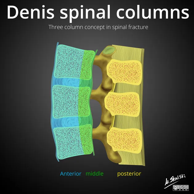 Denis three column concept of spinal stability