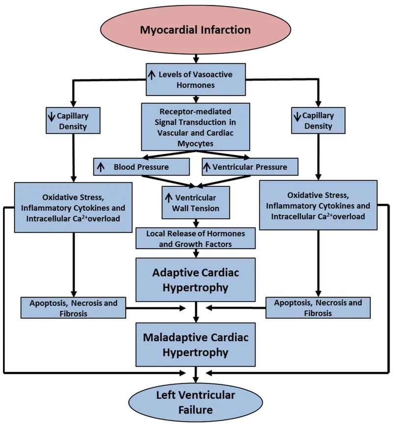 MI to LV Failure Pathway