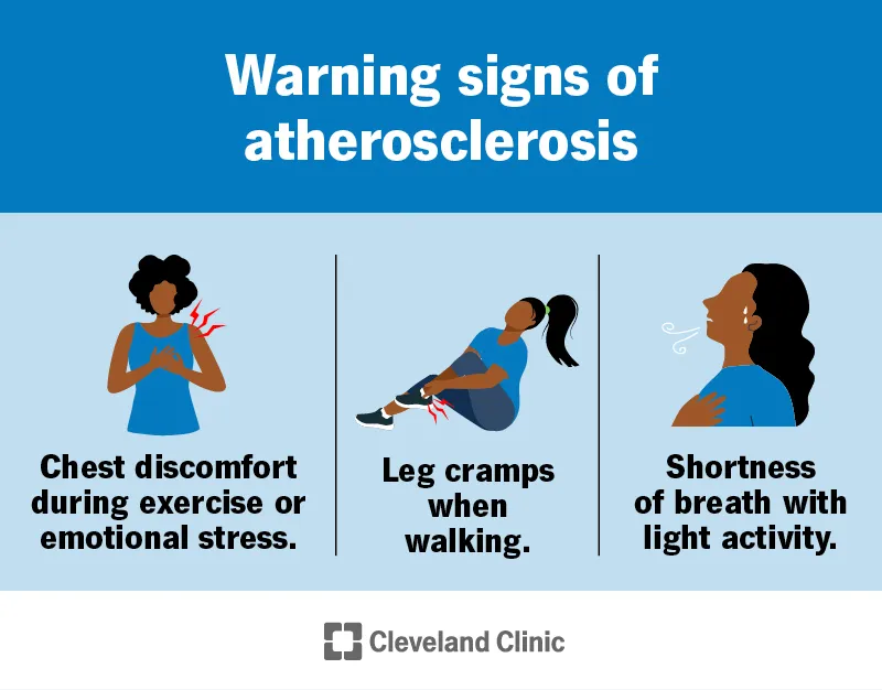 Warning Signs of Atherosclerosis
