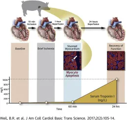 Myocardial stunning and troponin I levels after ischemia