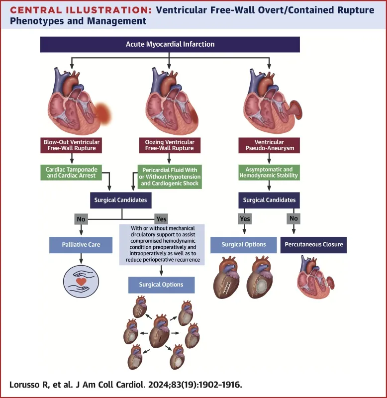 Ventricular Free-Wall Rupture Phenotypes and Management