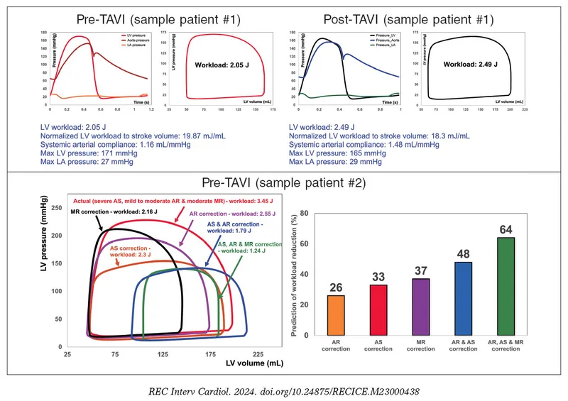 Pressure-volume loops for valvular heart disease