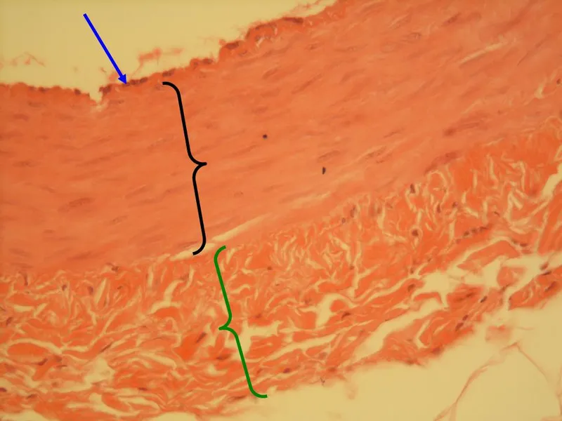 Histology of blood vessel wall layers