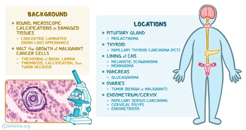 Psammoma bodies: background, histology, and locations