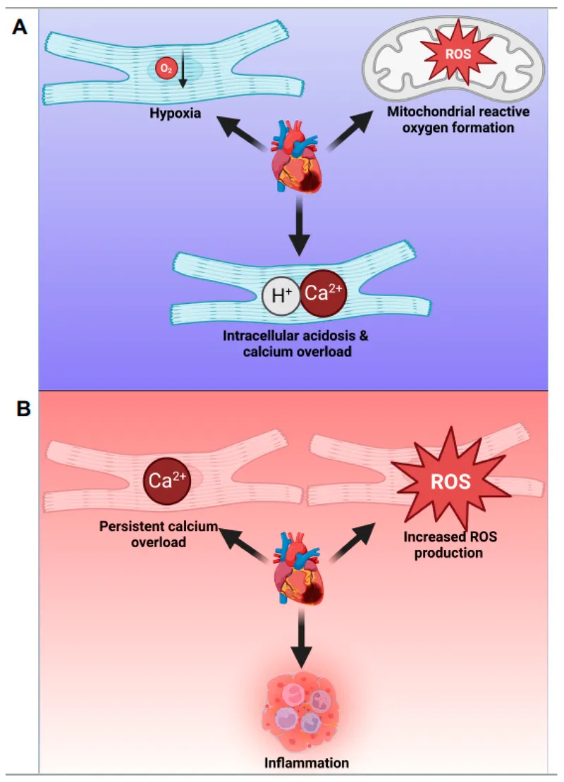 Ischemia-Reperfusion Injury Mechanism