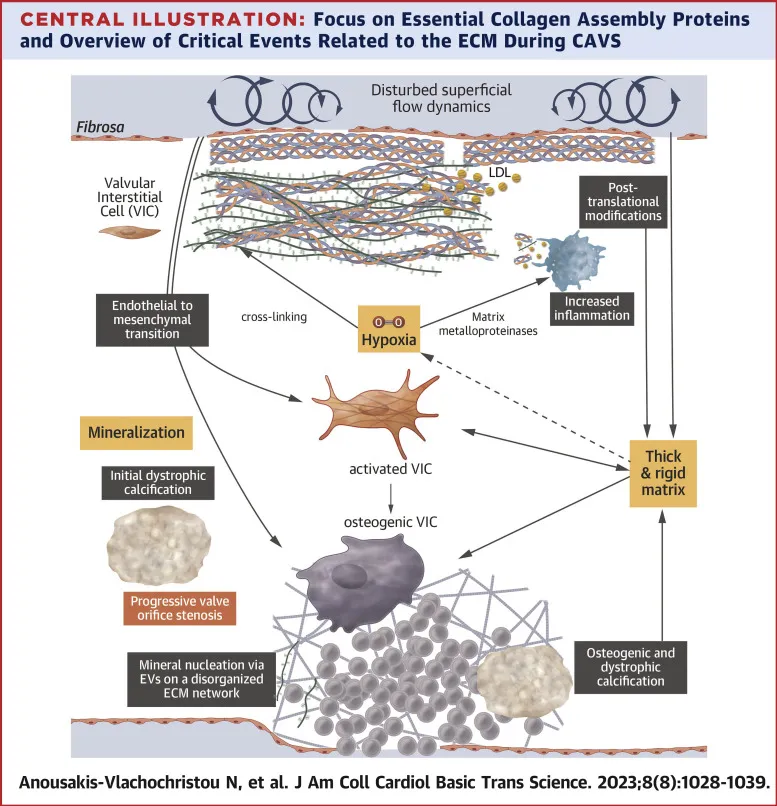 Pathogenesis of dystrophic calcification in aortic valve