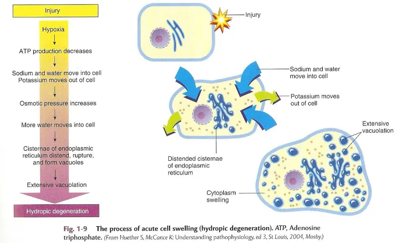 Reversible Cell Injury: ATP Depletion Mechanisms