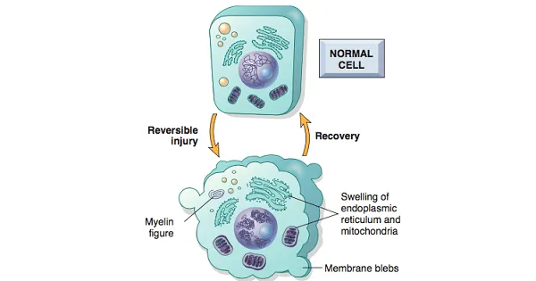 Reversible Cell Injury: Ultrastructural Changes