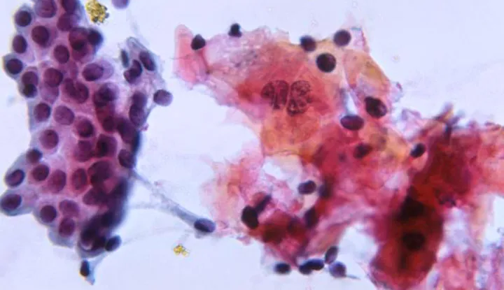 Microscopic view of GI cytology smear