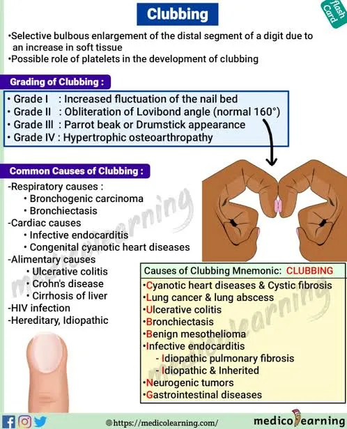 Clubbing: Grading, Causes, and Mnemonic