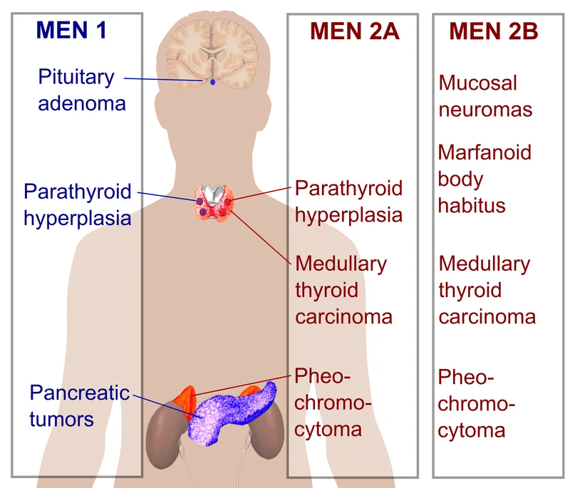 MEN 1, 2A, and 2B Syndromes