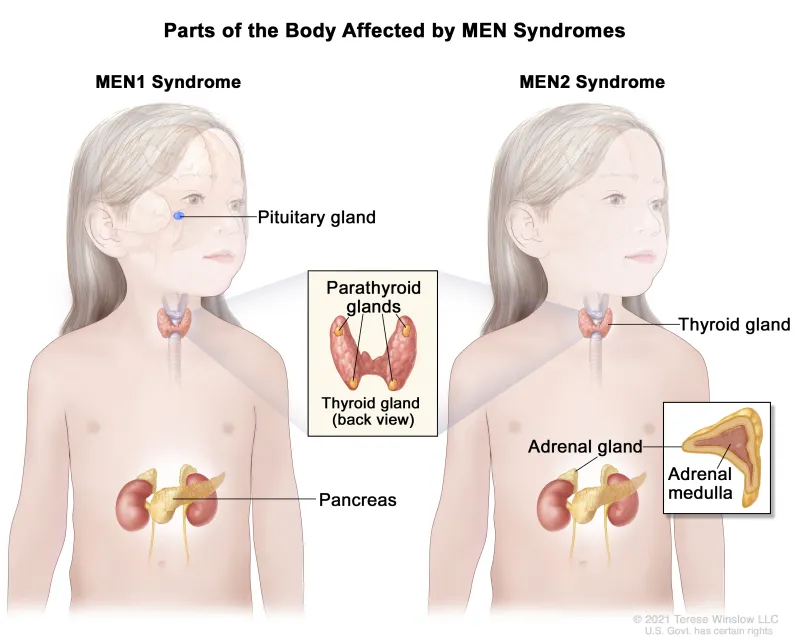 Organs affected by MEN1 and MEN2 syndromes