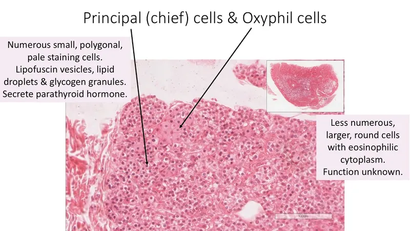 Parathyroid Gland Histology: Chief and Oxyphil Cells