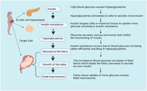 Pathophysiology of Gestational Diabetes and Fetal Macrosomia