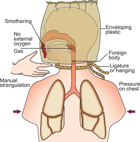 Mechanisms of Asphyxia