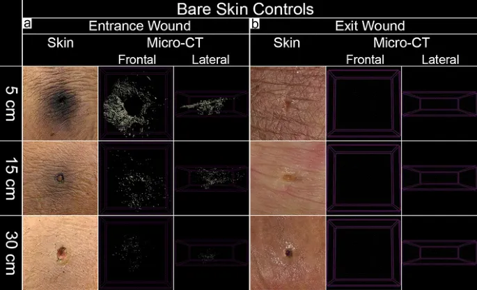 Gunshot wound entrance/exit at 5, 15, 30 cm