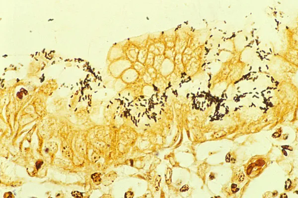 H. pylori bacteria on gastric mucosa (Warthin-Starry stain)