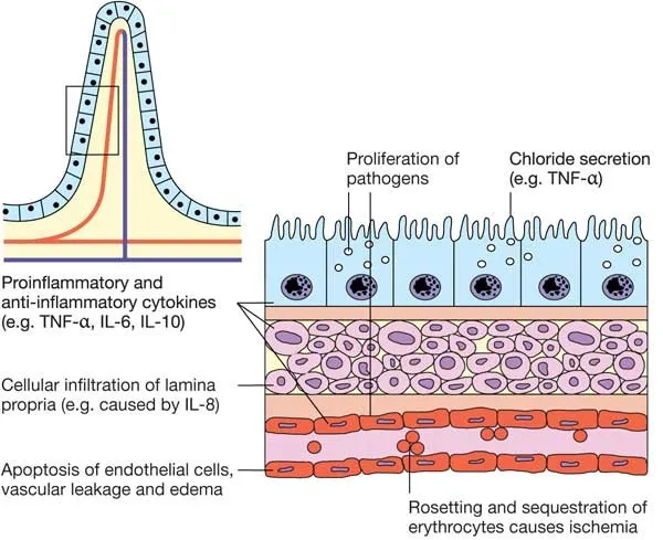 Pathophysiology of intestinal infections