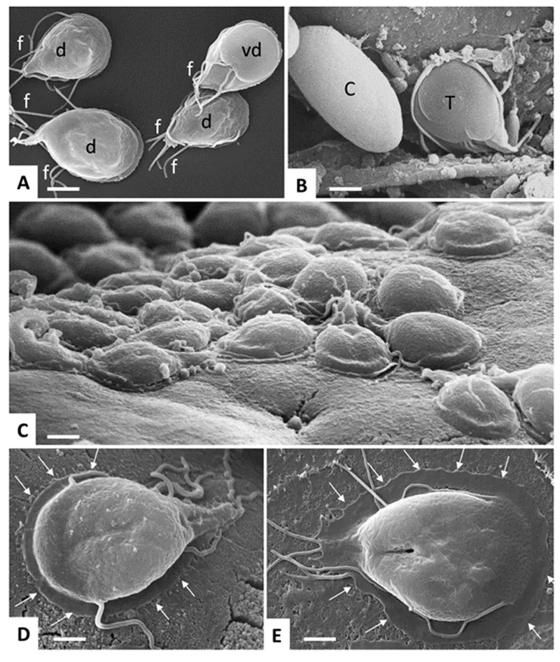 SEM of Giardia lamblia trophozoites and cysts