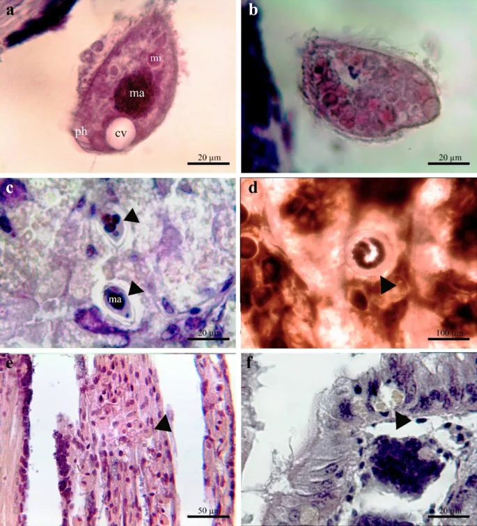 Micrographs of parasitic GI infections