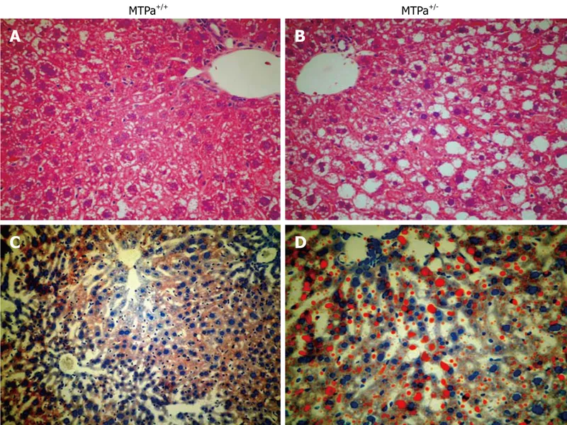 Liver steatosis with Oil Red O stain and signet ring cells