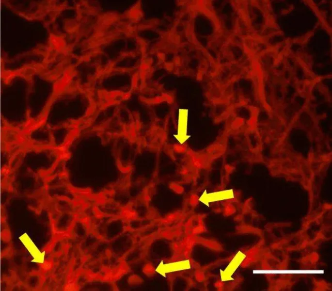 Fluorescent image of amyloid fibrils with Congo Red