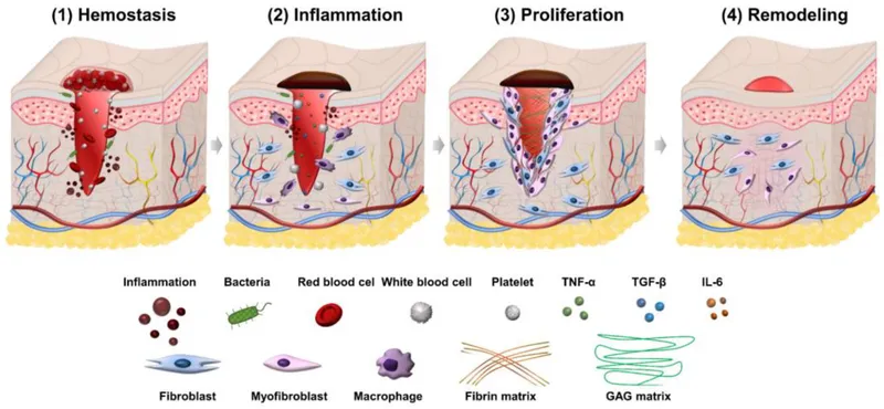Phases of Wound Healing Diagram