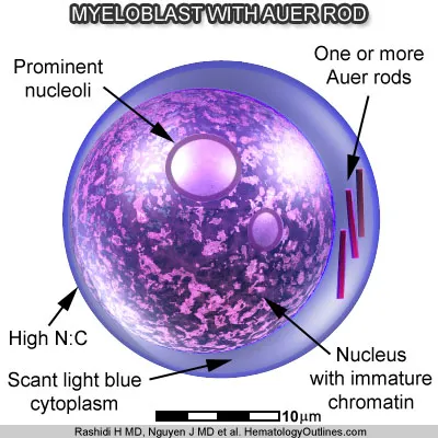 Myeloblast with Auer Rods Diagram