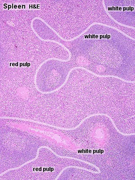 Spleen H&E: Red and White Pulp