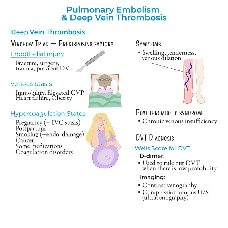 Virchow's Triad: Predisposing Factors for DVT
