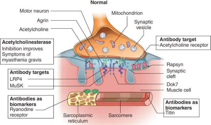 Myasthenia Gravis Neuromuscular Junction Autoimmunity