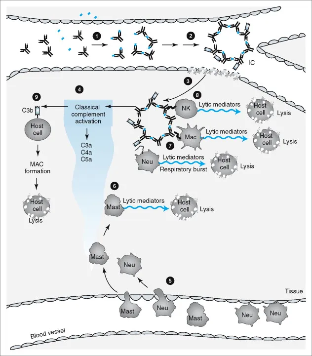 Type III Hypersensitivity Immune Complex Deposition