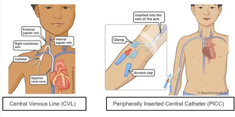 CVL and PICC Line Insertion Sites