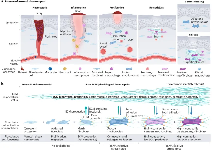 Normal tissue repair vs. fibrosis