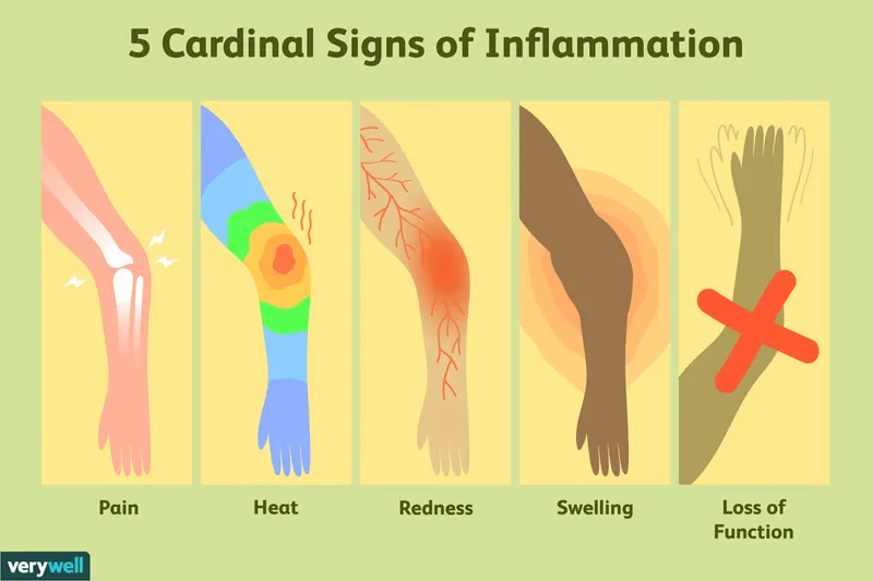 5 Cardinal Signs of Inflammation