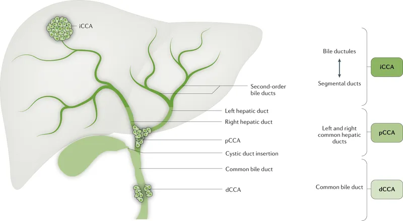 Types of Cholangiocarcinoma by Location