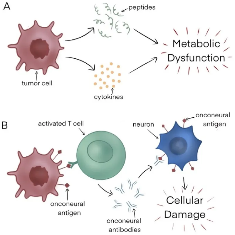Paraneoplastic syndromes mechanisms: metabolic & immune