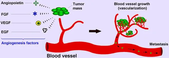 Tumor Angiogenesis and Metastasis
