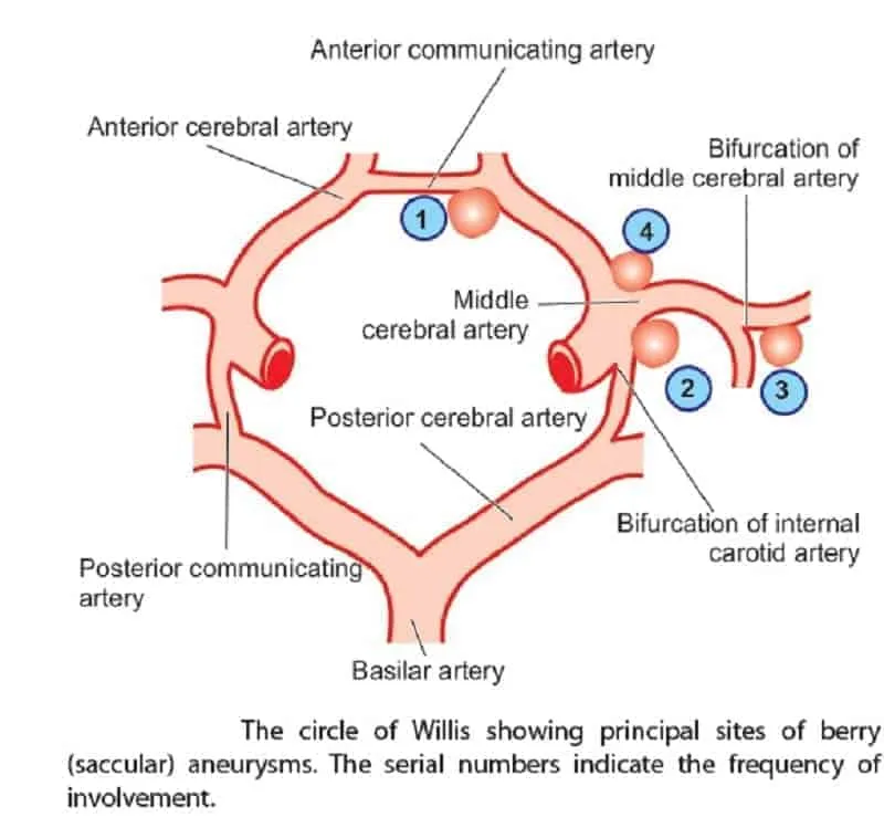 Circle of Willis with berry aneurysm sites