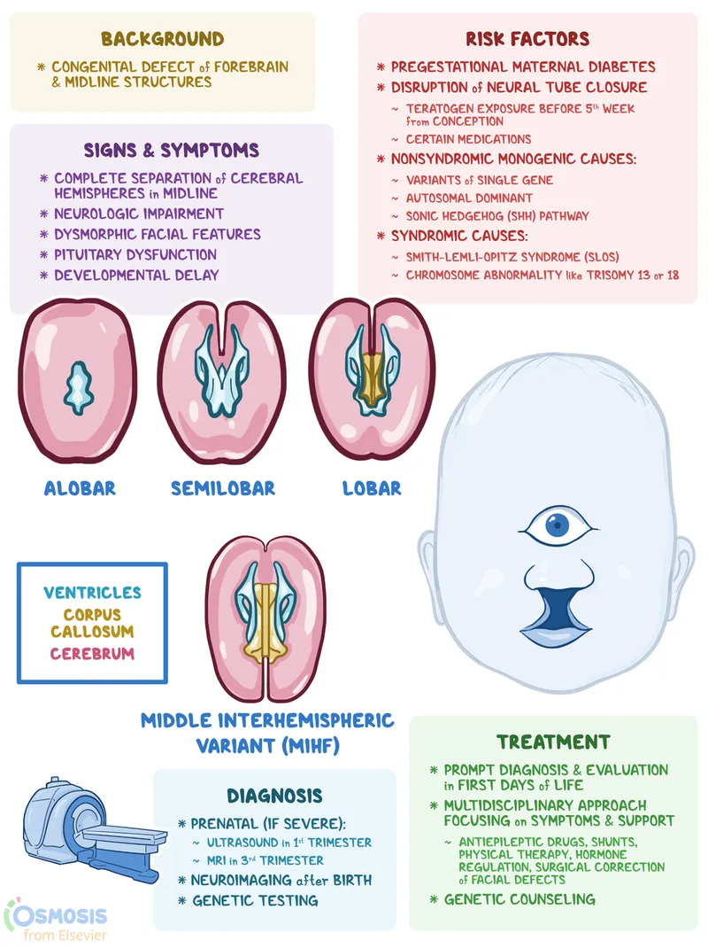 Holoprosencephaly types and features