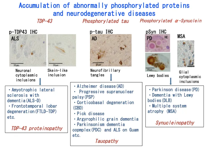 Protein Accumulation in Neurodegenerative Diseases