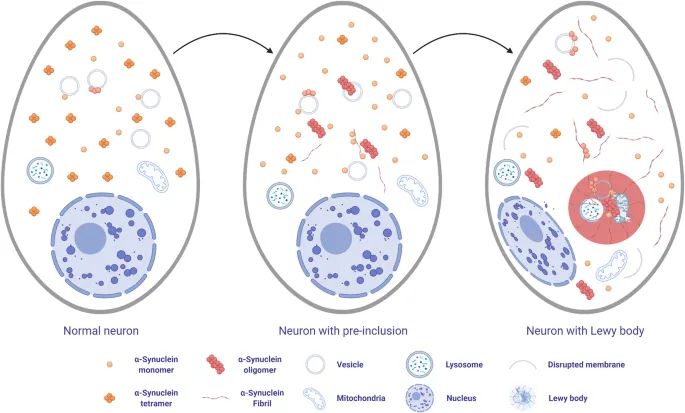 Lewy body formation in neurons