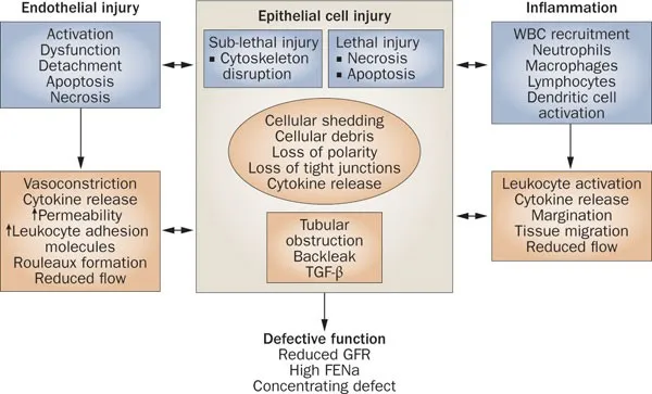 Pathophysiology of Acute Tubular Necrosis (ATN)