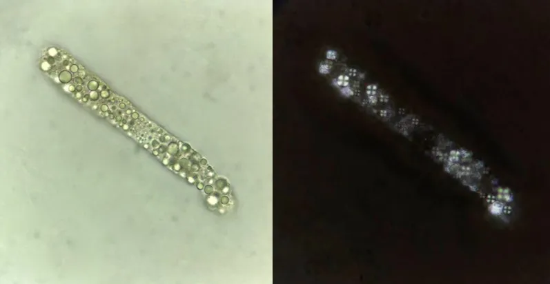 Fatty cast with Maltese cross under polarized light